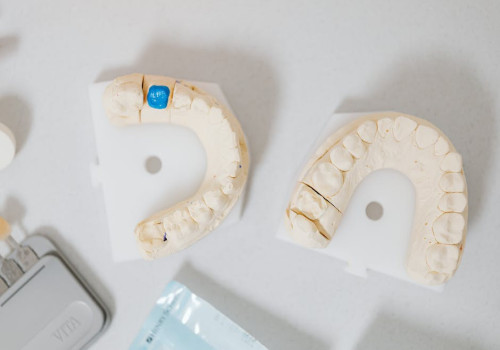 Waarom kiezen voor orthodontie?